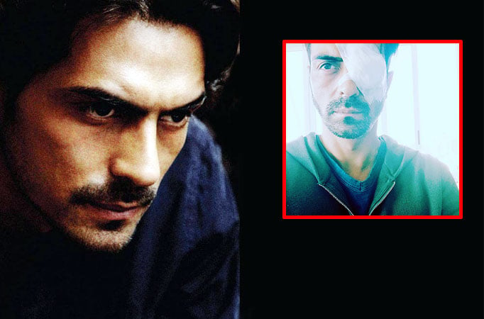 Arjun Rampal suffers eye injury