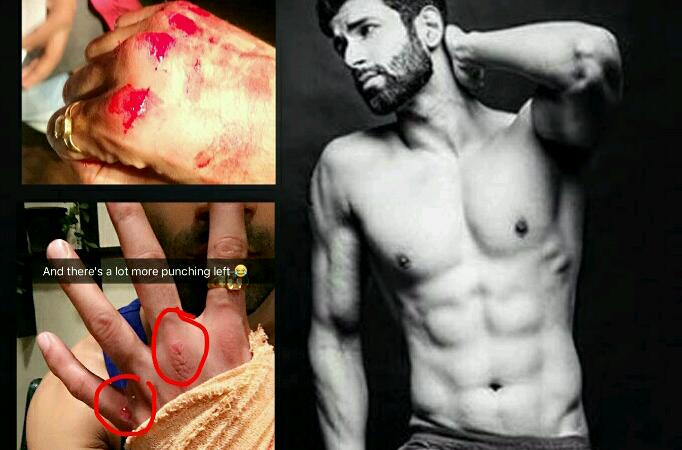 Ouch!! Namik Paul injured 